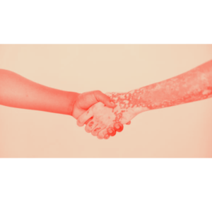 This image shows a person suffering from the skin disease psoriasis whose hand will be normal after the best homeopathic treatment