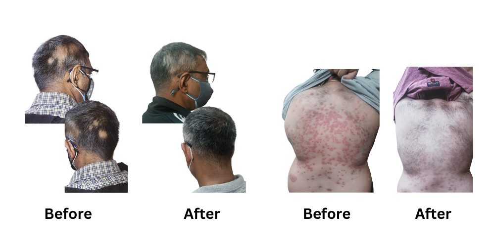 Results to prove that we are the best homeopathic doctors in Delhi.