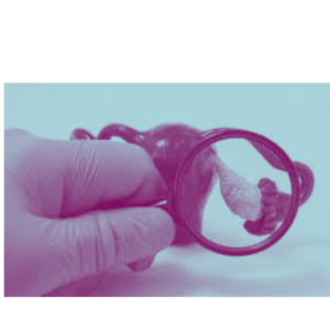 Image showing the model of ovary