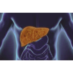 Causes of fatty liver