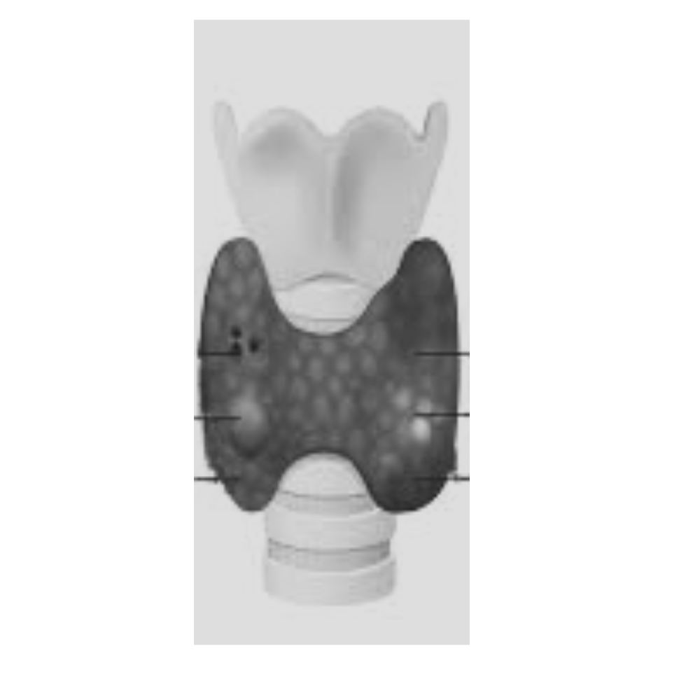 This image shows the thyroid gland