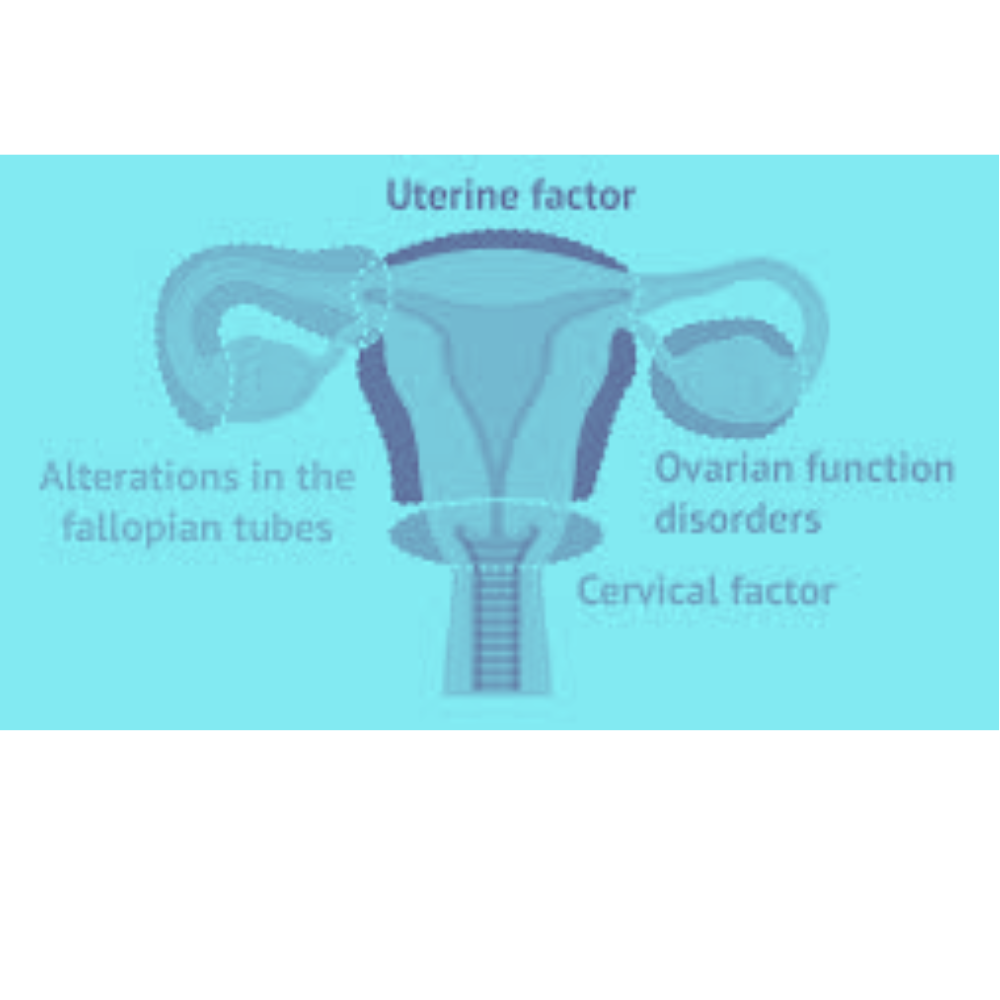 Best homeopathic treatment for pcos